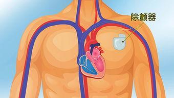 心脏复视频,揭秘生命泵动的奥秘与奇迹